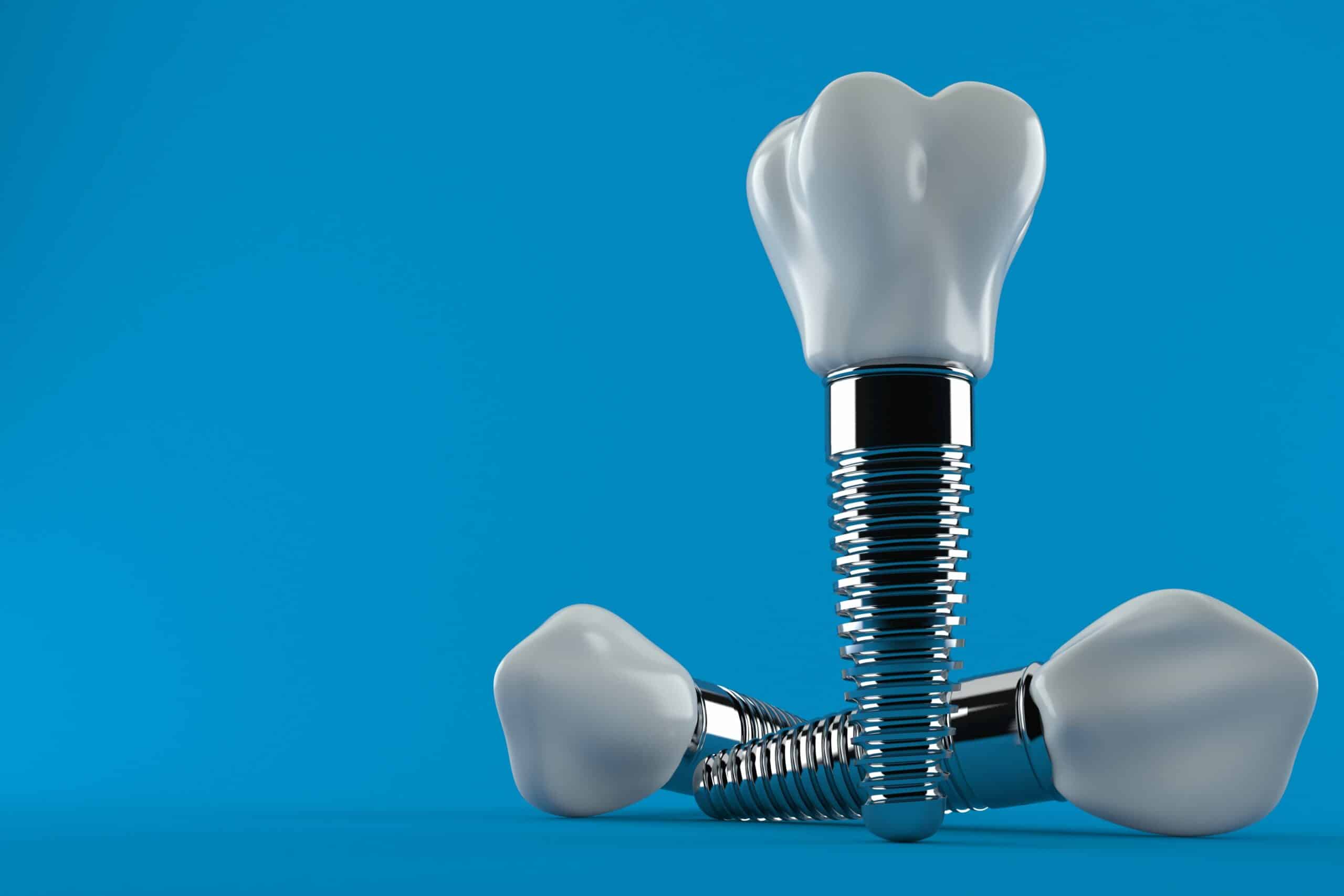 Single Tooth Implants in Flower Mound, TX | Genesis Dental