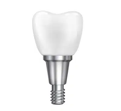 Dental implant