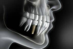 What-Are-The-Types-of-Dental-Implants