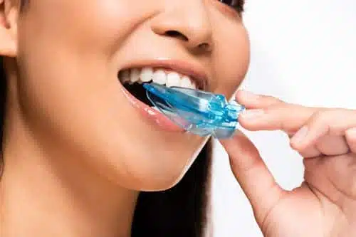 What Are The Benefits Of A Custom Mouthguard