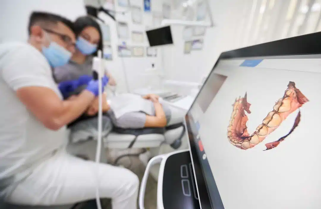 What Are The Benefits Of Digital Scanning