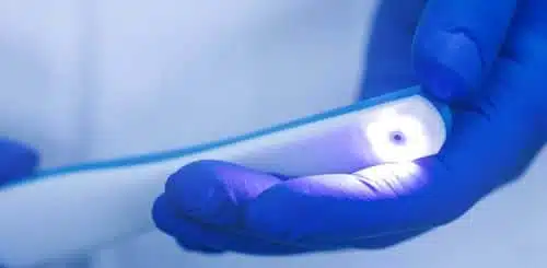 Who Is A Candidate For An Intraoral Camera Scanning