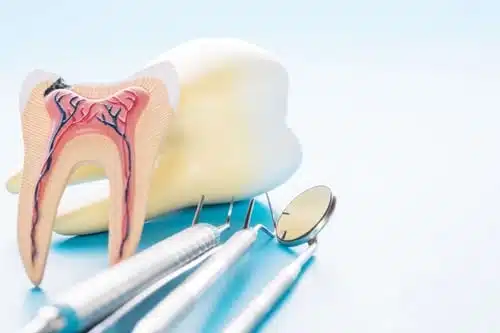 who-is-a-candidate-for-root-canals Who Is A Candidate For Root Canals