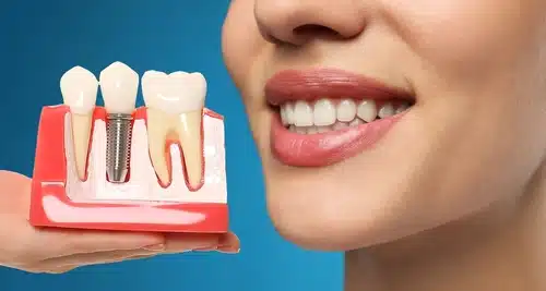 young,woman,with,beautiful,smile,and,dentist,holding,educational,model