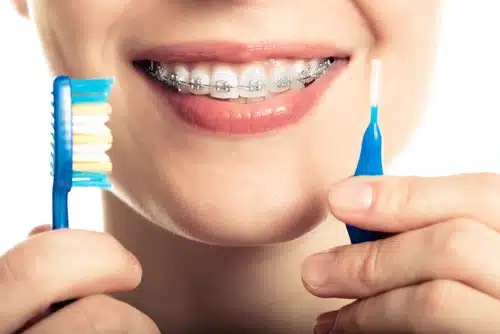 beautiful,smiling,girl,with,retainer,for,teeth,brushing,teeth,on